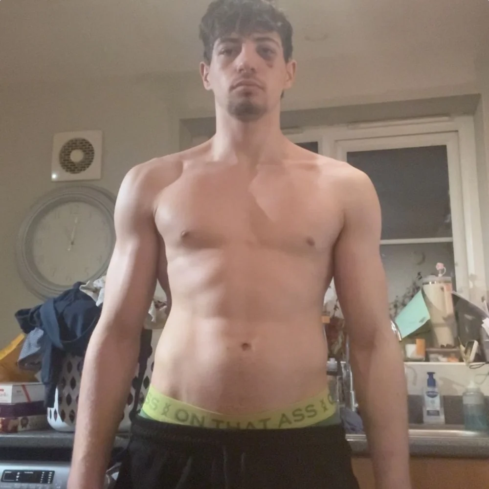Max - before